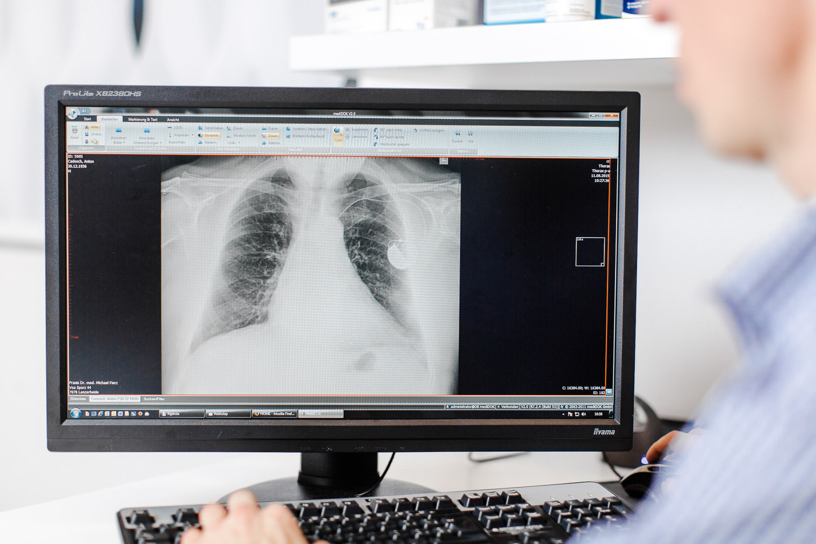 Digitales Röntgen - Die Bilder werden direkt auf den Computer gesendet